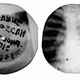 Illustration for article titled Soviet-era bootleg recordings made on discarded X-ray plates
